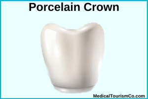 Porcelain crowns abroad