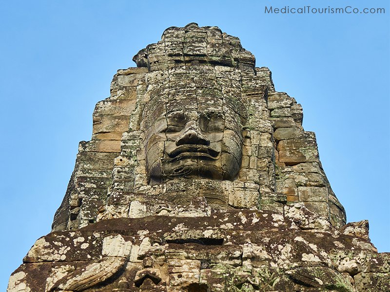 Angkor Wat temple- Dental Tourism in Cambodia