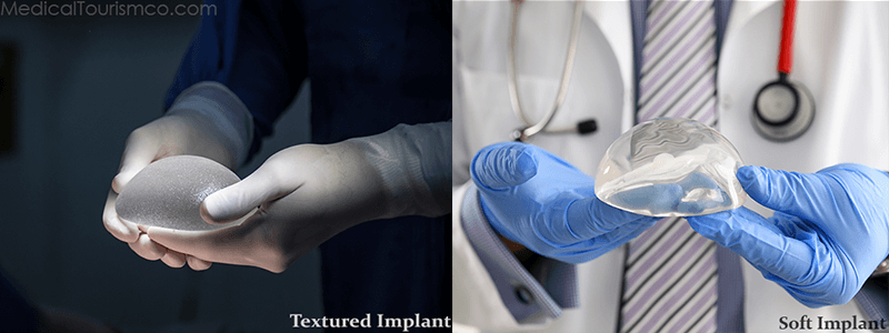 Breast Implants: Textured (left.) v/s Soft (rt.)