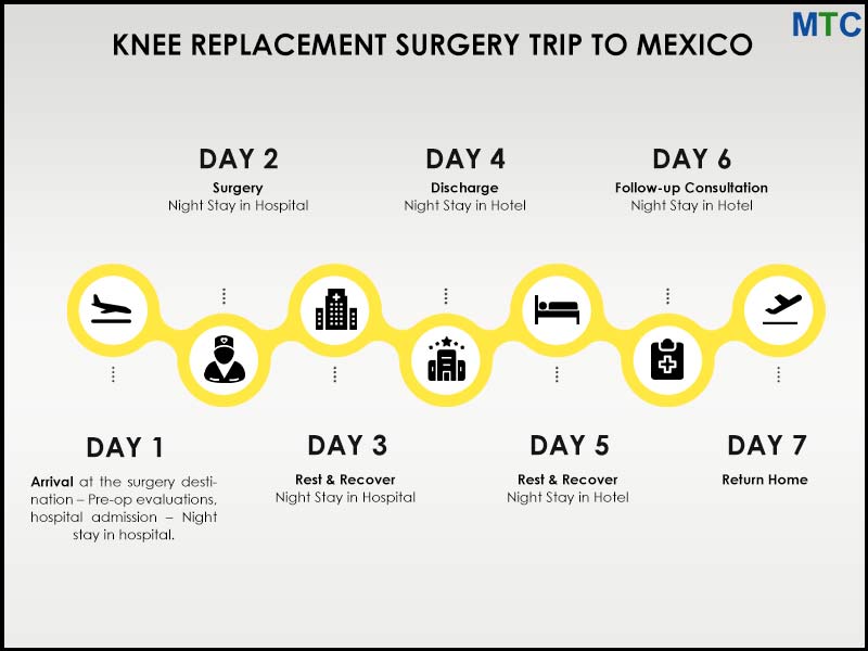 Knee Replacement in Mexico Schedule