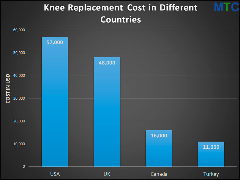 Knee Replacement Cost Comparison - Turkey vs. Other Countries
