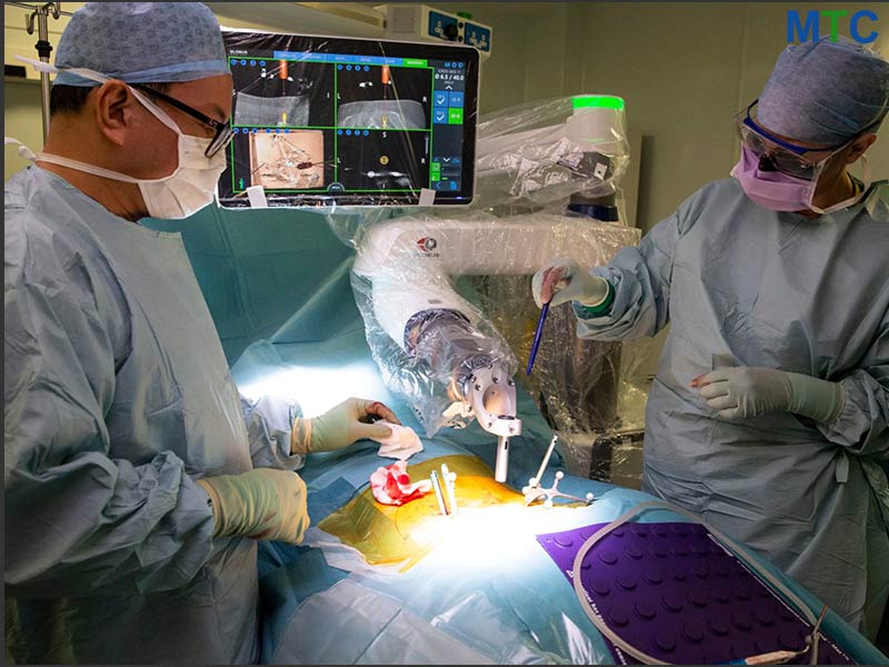 Robotic Surgery in India