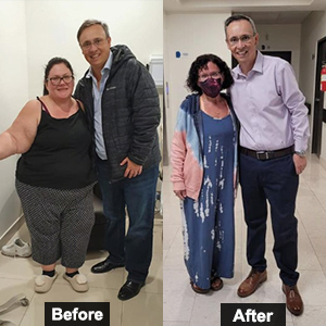WLS in Cancun, Mexico - Before & after