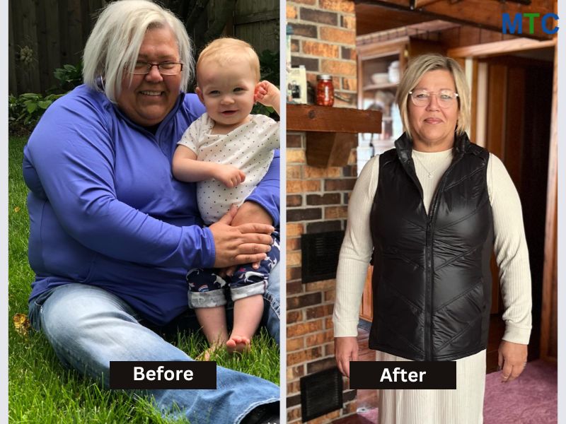 Tammy Smith Before and After Gastric Sleeve