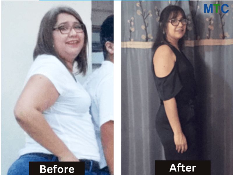 Ursula Reyez before and after gastric sleeve