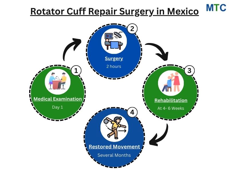 Rotator cuff repair surgery in Mexico